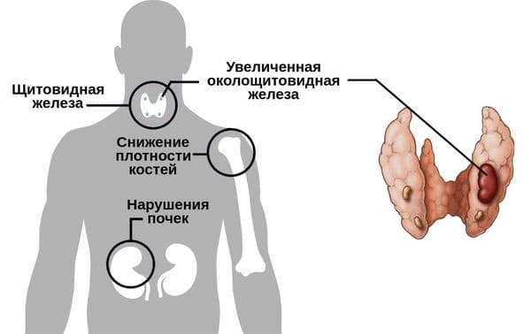 Расположение паращитовидных желез