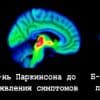 Микробиом кишечника связан с болезнями Паркинсона Альцгеймера и рассеянным склерозом
